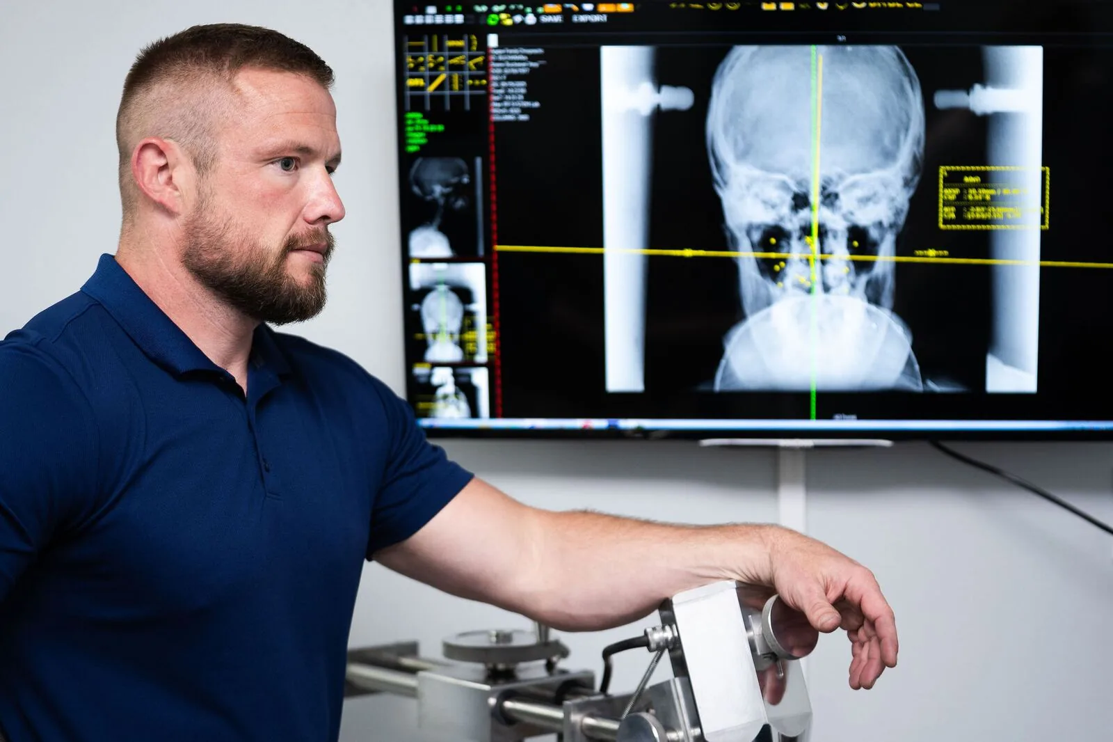 Dr. Max Orris reviewing upper cervical X-ray imaging at Gateway Upper Cervical Institute